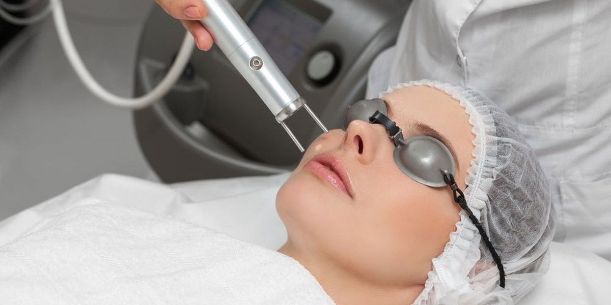 Professional Fractional CO2 Laser Procedure for Smoother and Healthier Skin