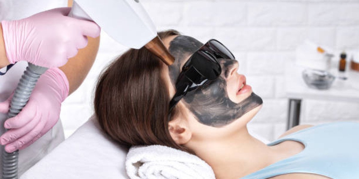 How does the carbon mask enhance laser effects?